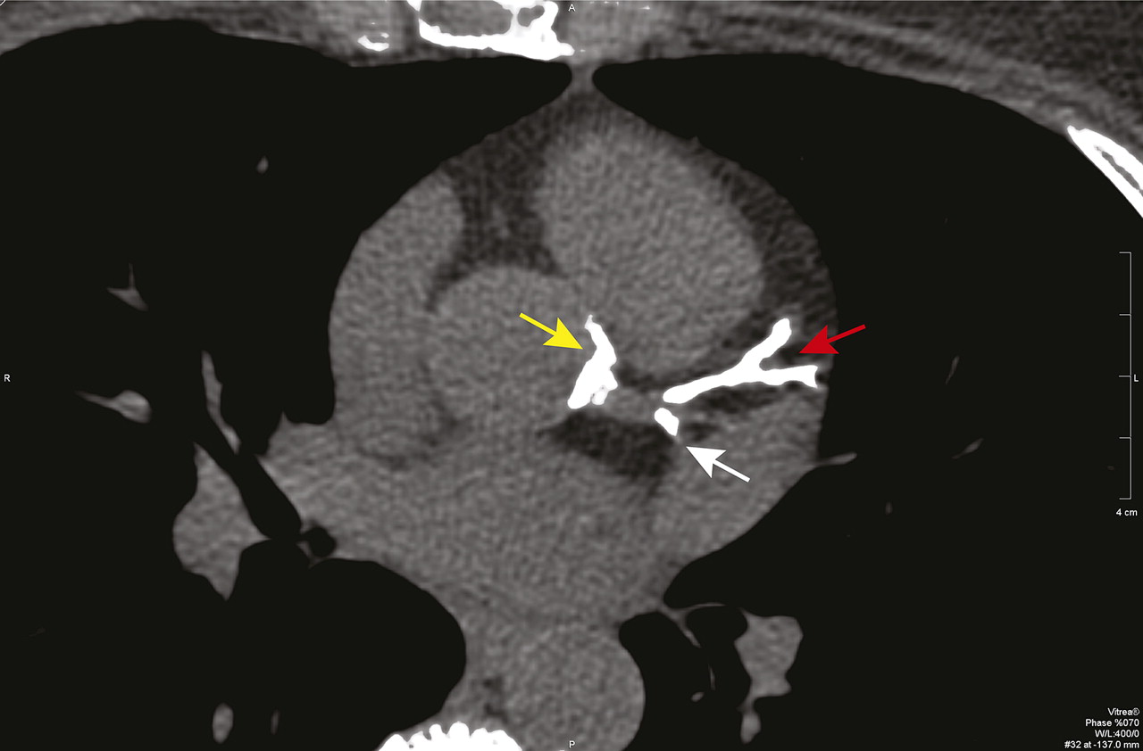 1665fig6