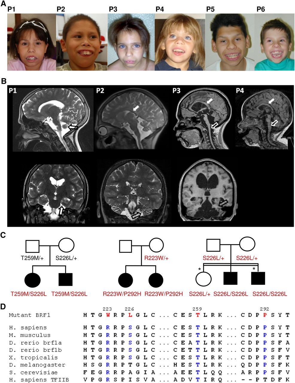 155fig1